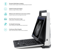 Machine à ultrasons Doppler à chariot numérique 3D 4D Scanner machine à ultrasons sonoscape e2