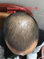 Shampooing au gingembre pour la perte de cheveux, produit de croissance capillaire, ml, afro et japonais