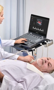 Échographe Doppler Couleur Portable Mindray MX5 MX-CB pour Diagnostic Vétérinaire - Prix et Suivi - Product Image 4
