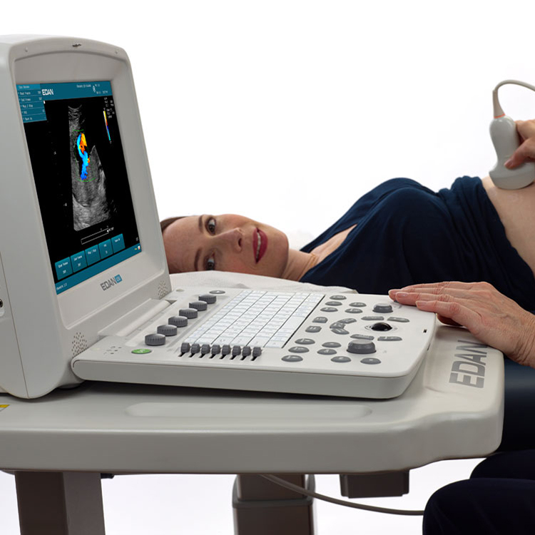 Sistema de diagnóstico de diagnóstico de Fábrica Edan U50 color gotero médico ultrasonido