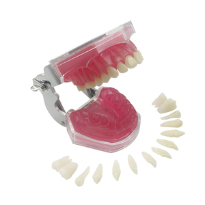 <span class=keywords><strong>Modello</strong></span> Anatomico Dentale Standard MX-039 con Denti Rimovibili, Tipo Dentale con Gengive Morbide per Studio, Insegnamento ed Educazione, Dimostrazione in Resina - Product Image 4