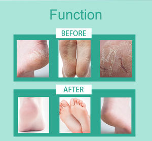 Masque coréen pour les mains et les pieds Masque pour les pieds au collagène pour enlever la peau morte Patches en silicone pour adultes Masque pour les pieds - Product Image 6