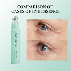 Oem <span class=keywords><strong>Best</strong></span> Sellers Levedura Bifid Iluminamento Anti Envelhecimento Niacinamida Clareamento Rosto Oil Roll on <span class=keywords><strong>Eye</strong></span> <span class=keywords><strong>Serum</strong></span> - Product Image 5