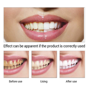 Efero – sérum nettoyant pour l'hygiène buccale, élimine les taches sur la Plaque dentaire, outils de blanchiment des dents, soins dentaires, blanchiment des dents - Product Image 6
