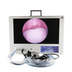 JOYMED, Endoscopio Médico Integrado, Diagnóstico Urológico, Cirugía, Imagen HD Clara, 24 Pulgadas, Fuente de Energía Eléctrica Todo en Uno - Product Image 4