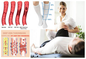 <span class=keywords><strong>Bas</strong></span> anti-embolie blanc à bout ouvert 13-18mmHg avec compression graduée et haut non restrictif pour les varices - Product Image 4