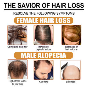 Custom Private Label Anti Loss Natural Organic Rice Water Fast Wild <b>Hair</b> <b>Growth</b> <b>Serum</b> Oil <b>for</b> Men <b>Women</b> - Product Image 3