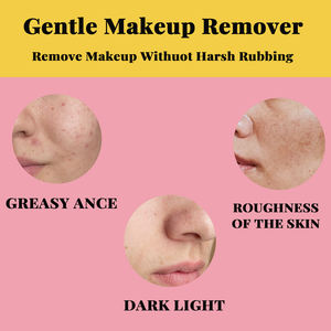 OEM ODM formule personnalisée marque privée peau oxygène dissolvant de points noirs <span class=keywords><strong>eau</strong></span> <span class=keywords><strong>micellaire</strong></span> nettoyante - Product Image 3