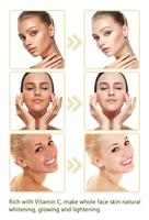 Thai Rose meilleure carotte vitamine C Gluta blanc kojique acide tranexamique Aloe Vera crème blanchissante hydratant pour le visage crème hydratante