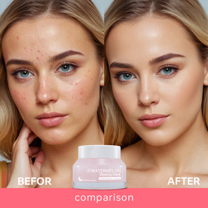 Watermelon Sleeping Mask Hydrates Repairs Barrier Brightens Dullness For All Skin Types Night Use <b>Face</b> Neck 50ml - Product Image 5