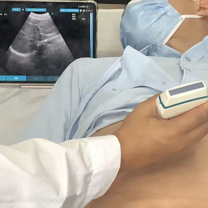 Giá nhà máy thấp nhất 128 yếu tố không dây lồi tim tuyến tính đầu dò 3-in-1 2-in-1 màu máy siêu âm máy - Product Image 2