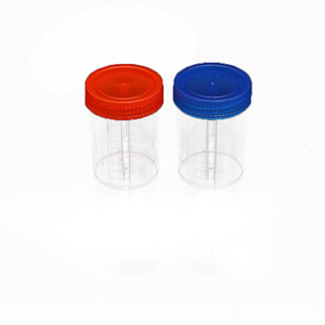 Gobelet de prélèvement médical Shengchuang 40 ml en plastique gradué avec couvercle jetable pour la collecte d'urine et de crachats - Product Image 1