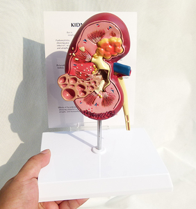 نماذج أبحاث التشريح الطبي ، عالية الجودة, نماذج أمراض الكلى ونماذج الكلى الصحية - Product Image 5