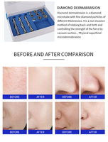 Appareil d'hydrodermabrasion à jet d'oxygène - Rajeunissement de la peau et lifting du visage - Vente en gros pour les cliniques de beauté professionnelles
