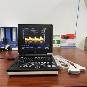 Échographe Doppler Couleur Portable 3D pour Hôpital, Machine à Ultrasons Portable pour Grossesse, Échographe Vétérinaire - Product Image 2