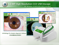 Caméra d'iriscope automatique, logiciel d'analyseur, 21mm