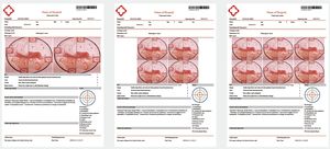 Sistema <span class=keywords><strong>de</strong></span> Colposcopia Profesional CE para Clínicas <span class=keywords><strong>de</strong></span> Salud Femenina, Equipo <span class=keywords><strong>de</strong></span> Videocolposcopio Digital OB GYN, Kernel KN-2200 - Product Image 3