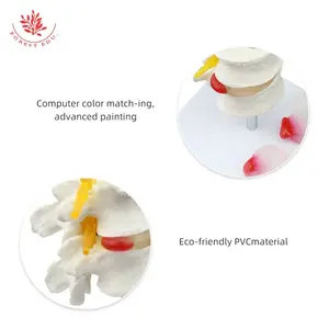 Modello di patologia della colonna lombare FRT038 Herniat disk modello patologico della Vertebra lombare umana - Product Image 3
