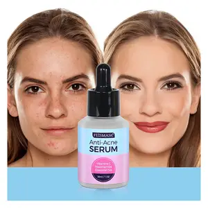 Niacinamide Lichaam Vitamine C De Gewone Originele Producten Huidverzorging Anti Acne Serum Visage