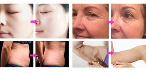 Système amincissant tout-en-un 16 poignées Cryolipolyse <span class=keywords><strong>Cavitation</strong></span> 40K Lipolaser RF <span class=keywords><strong>Appareil</strong></span> de remodelage corporel et d'élimination des graisses - Product Image 6