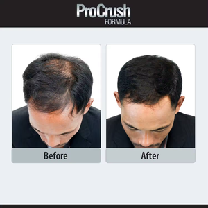 לוגו מותאם אישית לוגו, ויטמין b6 b12 ו ביוטין תוספי קפסולות שיער & ביוטין קשה קפסולה - Product Image 5