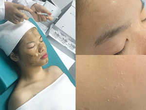 ฟองน้ำไฮโดรไลซิส,สารสกัดจากฟองน้ำ Spicules Peel ไบโอปอกเปลือก - Product Image 4
