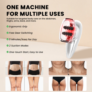 Appareil de massage anticellulite sans fil électrique à ventouses pour le remodelage corporel et la combustion des graisses - Product Image 3