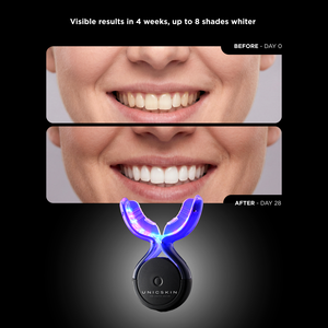 UNICSKIN WHITE SMILE 5.0 Appareil de blanchiment des dents à domicile LED Réduit les taches d'émail Soutient les soins des gencives et améliore la santé bucco-dentaire globale - Product Image 5