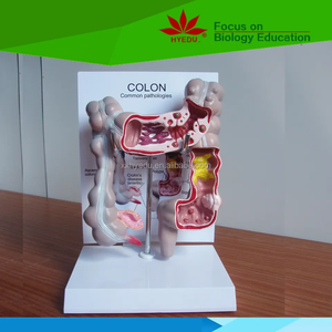 Modèle anatomique humain agrandi pour l'enseignement médical : système digestif, appendice et cæcum - Product Image 3
