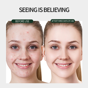 Crema facial reparadora hidratante orgánica aceitunas o aloe acné eliminar espinillas Crema para el acné - Product Image 6