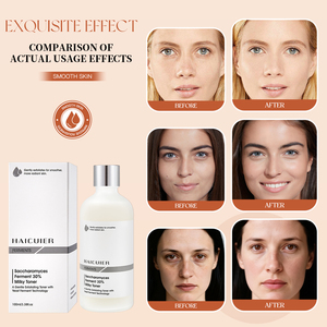 Chăm sóc da dưỡng ẩm đốm đen giữ ẩm Làm trắng Chống lão hóa nhăn làm săn chắc lên men 30% sữa mặt Toner - Product Image 4