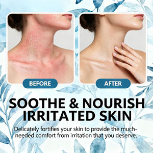 Crema para Dermatitis Seborreica, Crema para Psoriasis, <span class=keywords><strong>Tratamiento</strong></span> para Dermatitis Seborreica, Crema para Eccema y Psoriasis para Cuero Cabelludo y Piel Seca - Product Image 3