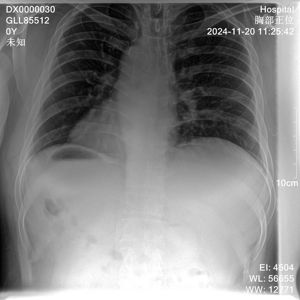 Máquina de Rayos X Portátil para Diagnóstico Médico, Sistema DR Médico, Precio de Máquina de Rayos X Veterinaria Portátil - Product Image 2