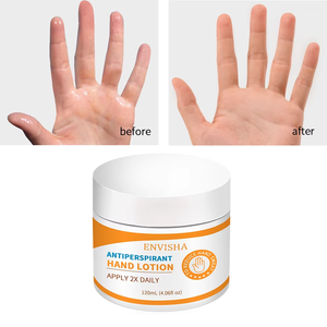 Loción antitranspirante de fórmula vegana al por mayor para manos, crema desodorante hidratante antisudor de absorción suave para manos y axilas - Product Image 2