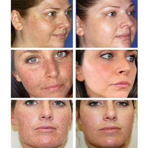 Ofertas Imperdíveis 30ml Marca Própria Creme Facial Clareador para Remoção de Manchas Escuras e Melasma - Product Image 6