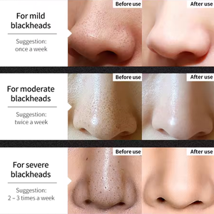 Oem than loại bỏ mụn đầu đen mũi Dải Mặt Nạ Trà Centella chiết xuất làm sạch sâu <span class=keywords><strong>Peel</strong></span>-Off mặt nạ cho mụn trứng cá dễ bị da - Product Image 3