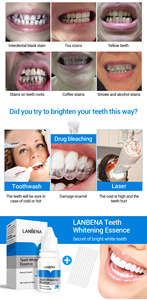 Essence blanchissante pour les dents, sérum nettoyant pour les dents, soins bucco-dentaires, hygiène dentaire, fabrication sous marque privée OEM - Product Image 4