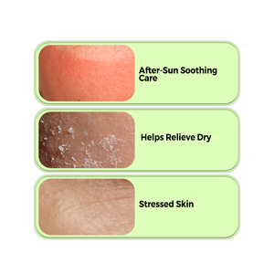 Nouvelle Crème Hydratante Après-Soleil OEM 2026 – Lotion Quotidienne de Soin pour Travailleurs en Extérieur – Protection Quotidienne au Gel d'<span class=keywords><strong>Aloe</strong></span> Vera - Product Image 2