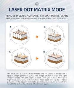 Láser fraccional de CO2, eliminación de arrugas, estrías, máquina de eliminación de cicatrices, láser Co2 para aclarar las manchas oscuras, máquina láser Co2 - Product Image 4