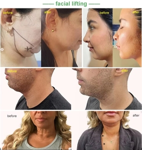 2025 chuyên nghiệp y tế 980nm1470nm tối thiểu xâm lấn sợi vaser hút mỡ máy endo Laser nâng mặt - Product Image 5