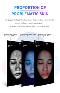 Profesyonel cilt analizörü güzellik enstrüman dermatoloji klinikler ve güzellik salonları için yüksek hassasiyetli yüz teşhis aracı - Product Image 5