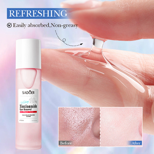 El Tónico Facial Más Popular de SADOER con Nicotinamida para Blanquear, Eliminar Pecas, Hidratar y Reparar la Piel - Product Image 5
