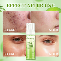 CHIC BEAUTE Nettoyant Visage Moussant à l'Arbre à Thé 200ml – Contrôle du Sébum, Anti-Acné, Éclaircissant, Acides Aminés