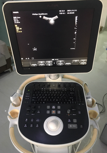 Fourniture et réparation de machine à ultrasons CV550 ,CV580 ,CV650, carte ACQ CV850, carte de canal, carte CB, alimentation de carte PC - Product Image 4