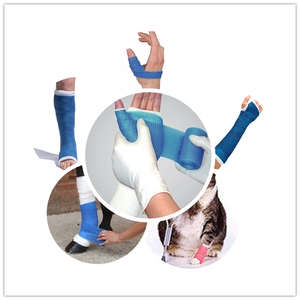 Fracture orthopédique bras jambe utilisation bande de coulée plâtres moulés médicaux de Paris gypse Pop Bandage premiers soins ISO approuvé - Product Image 3
