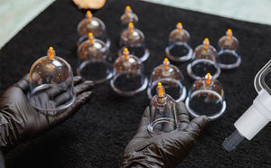 伝統的な中国医学18個セット真空カッピングセットプラスチック製ヒジャマカッピングセット - Product Image 2