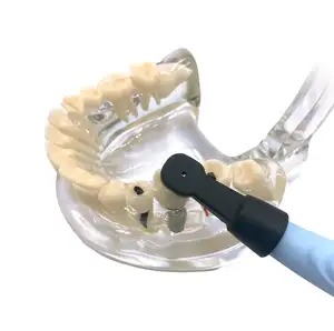 Easyvidasını tam olarak yerleştiren Easyinsmile diş Implant dedektörü