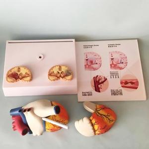Modelo Anatómico de Fibrilación Atrial con Secciones Transversales de Corazón y Cerebro para la Enseñanza de Cardiología - Product Image 3