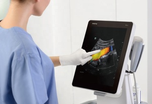 Appareil d'échographie mobile vétérinaire Mindray TE5 VET, système d'imagerie diagnostique ultrasonore numérique pour animaux - Product Image 5