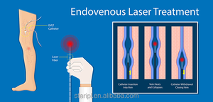 Máquina Médica Láser Nd Yag de 980nm + 1470nm EVLT - Portátil de Alta Potencia <span class=keywords><strong>para</strong></span> la Eliminación de Venas Varicosas y <span class=keywords><strong>Tratamiento</strong></span> Vascular Eficiente - Product Image 3